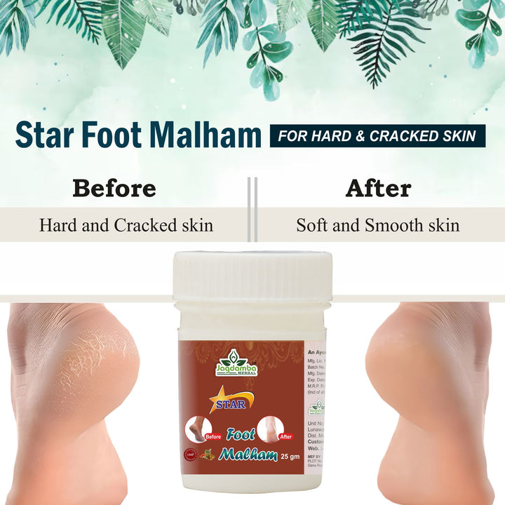Star Foot Malham: Ayurvedic Relief for Cracked Heels and Foot Pain (PACK OF 3)