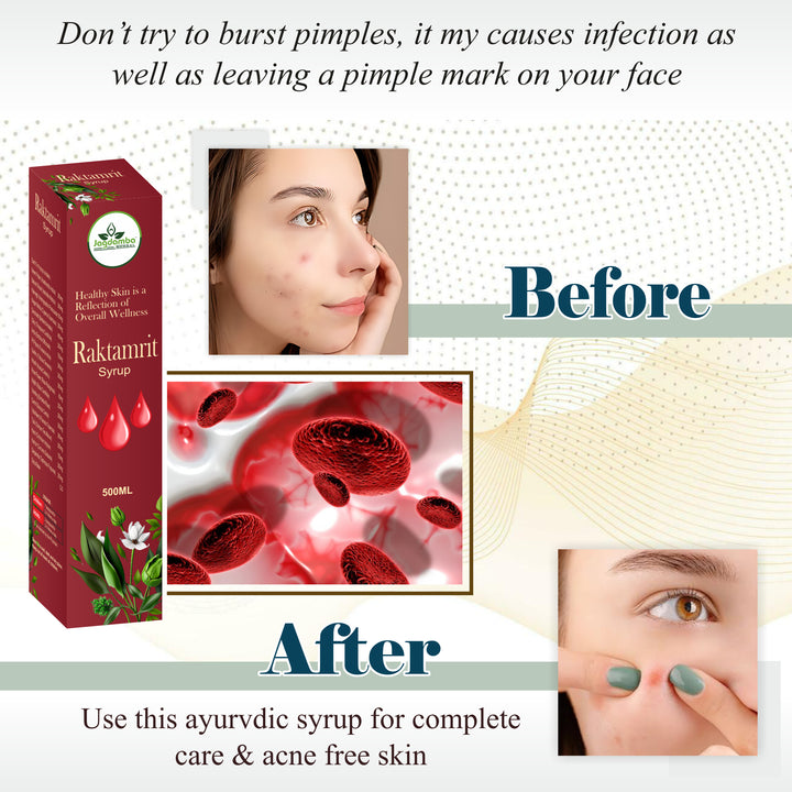 Advertisement for a ayurvedic syrup with before and after effects on skin, showing a box and close-up images.